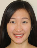 Dr. Helen Chea, MD
